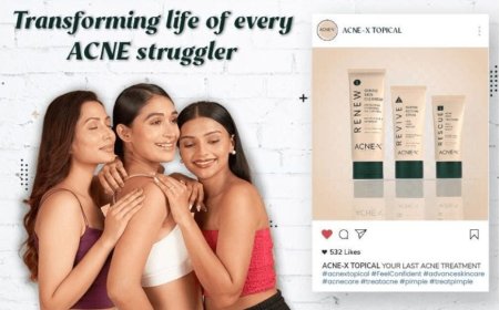 Radiant Skin Unleashed: The Glamorous Transformation with Acne-X Topical